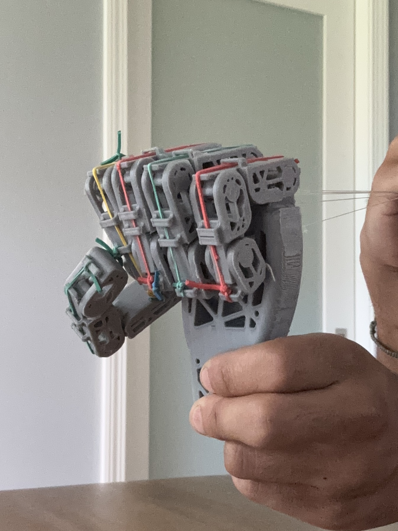 Prosthetic hand making a fist